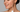 Clearer Skin Starts Here: The Benefits of Using a High Frequency Device for Acne