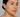 Hyperpigmentation: Causes & How GlowIQ Devices Can Help You Achieve Clearer Skin
