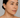 Hyperpigmentation: Causes & How GlowIQ Devices Can Help You Achieve Clearer Skin
