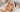 Reveal Your Best Skin: The Benefits of Skin Peels